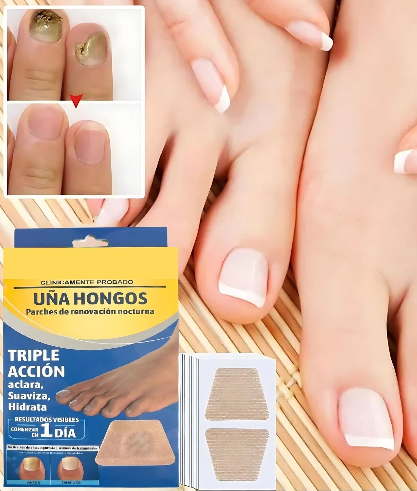 PARCHES ANTI HONGOS PARA UÑAS